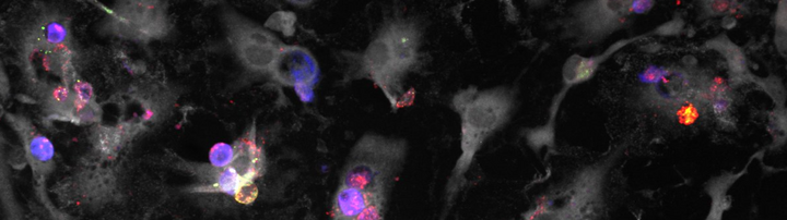 scientific image of lymphocytes