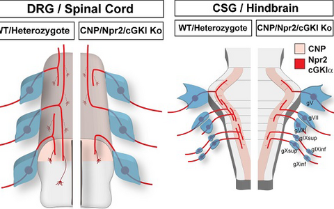 Schematic representation of the bifurcation defects observed in the absence of cGMP signaling in axons from dorsal root ganglia (DRG) in the spinal cord and cranial sensory ganglia (CSG) in the hindbrain