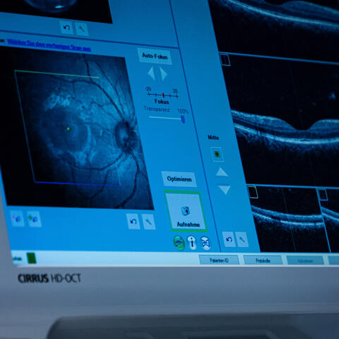 Hanna Zimmermann Examination of the retina skin
